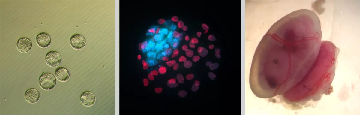 UCSF Lab of Paolo Rinaudo, MD, PhD